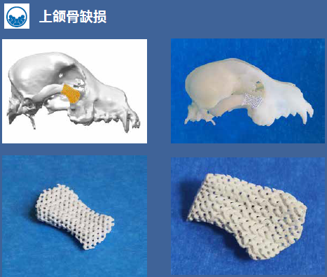 利用3D陶瓷打印机成功打印出上颌骨缺损修复零件，为患者提供了精准适配的个性化骨修复解决方案，显著提升了缺损修复效果和术后生活质量。