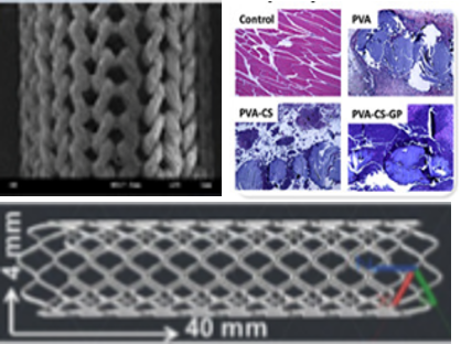 通过3D打印得到一种可生物降解的PCL-石墨烯复合支架(PCL-GR支架)，其具有优异的力学性能，体外细胞实验表明，该支架无明显细胞毒性。在猪模型中的离体可行性研究也证实了其未来应用于人体的可能性。